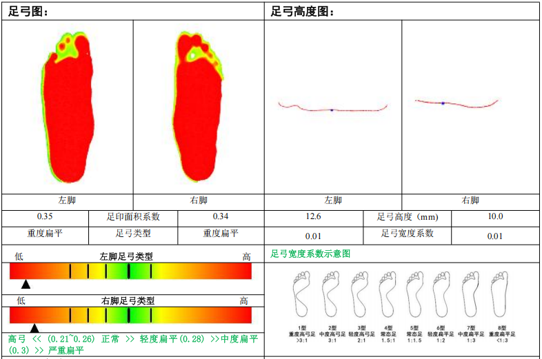 儿童步态调整案例展示——扁平足（4）