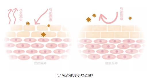 宝宝牛奶过敏却从未长湿疹？丨这份“奇迹”背后，离不开妈妈每天坚持做这件事